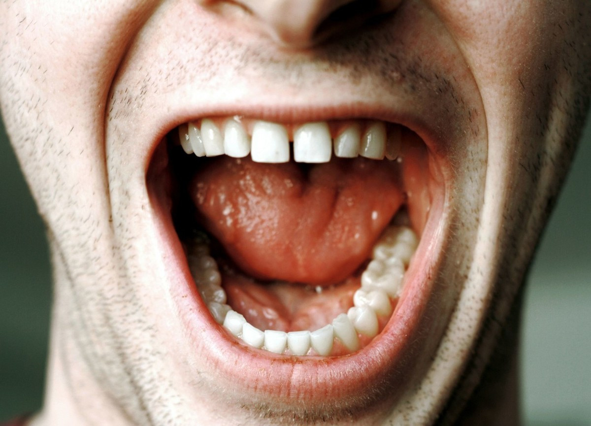 牙缝又大又粗怎么办?不想影响财运和颜值,2件事请知晓