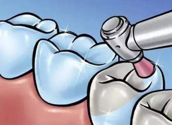 补牙后的这些注意事项,80%的人一定都不知道!